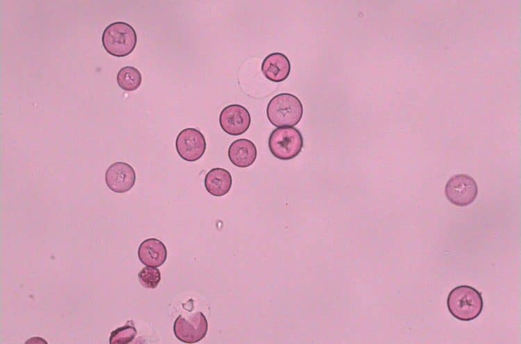 Cupressus pollen (Transmitted Light, color), 40X Obj. -#LCACHN-PH40x