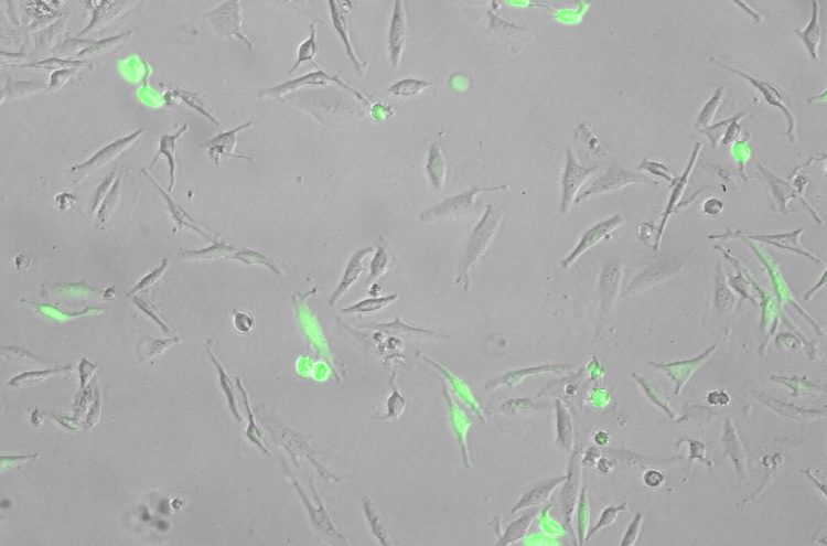 Transfected HeLa cells (GFP F.L.M.)(Transmitted Light PH), 20 X Obj. #LCACHN-PH20X