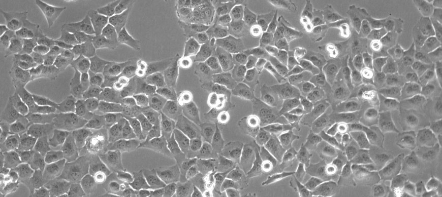 adherent-cell-counting_incellis