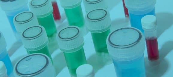 Choisir le bon kit de lyse pour l'homogénéisation des échantillons