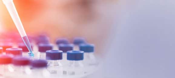 Détection des protéines spécifiques par Western Blot
