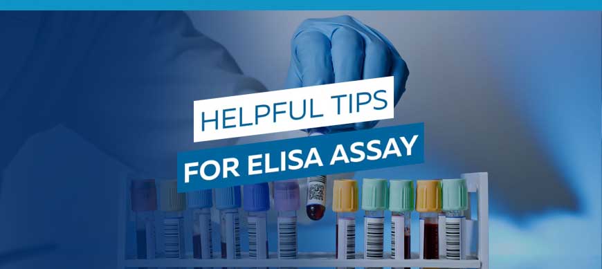 [VIDEO] 4 conseils pour un test ELISA réussi Bertin Technologies 41539