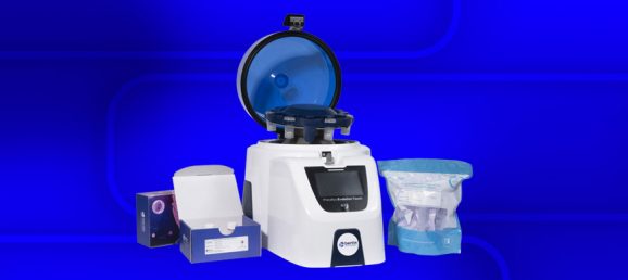 Comparative-Tissue-Dissociation-Performance-Precellys