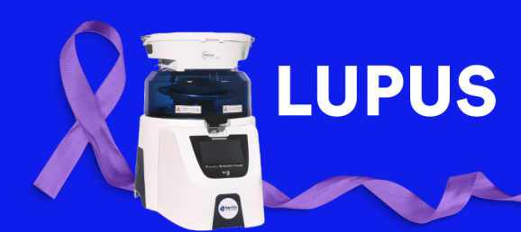 MMP‑9 : un nouvel allié contre les complexes immunitaires dans le lupus Bertin Technologies 82770