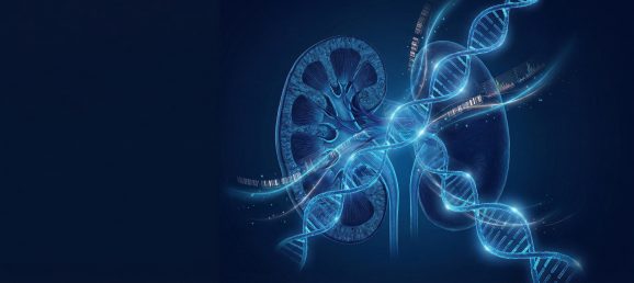 Isolation d’ARN à partir de reins sains et kystiques — Yale University valide un workflow avec le Precellys Evolution Touch Bertin Technologies 93445